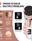 Electronic Foot Files Portable Foot Callus Remover