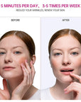 New Upgraded Therapeutic Warmth Face Massage