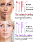 High Frequency Facial Machine Electrotherapy Wand