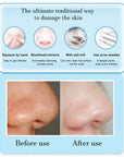 3 Suction Mode Face Cleansing Beauty Machine